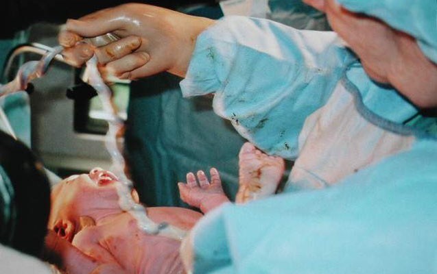 Azərbaycanda daha bir doğuş faciəsi - Əkiz oğlanlardan biri öldü