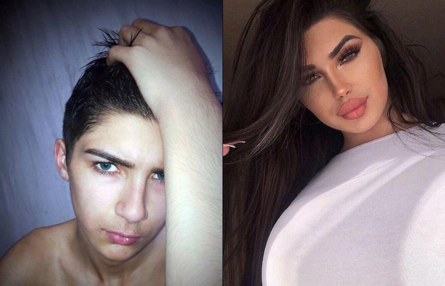 17 yaşlı transseksual Kim Kardaşyana bənzəmək üçün əməliyyat etdirdi - FOTOLAR