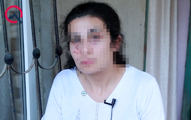 Bakıda zorlanmadan son anda qurtarılan qadın danışdı - Video