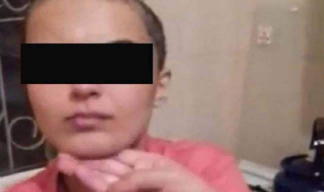 Saçı qırxılan qadına verilən işgəncə izlərinin şok görüntüləri - Fotolar +18