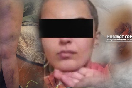 Arvadının saçını qırxan kişi danışdı: “Onun yad kişilərlə yataqda çəkilmiş videoları var”