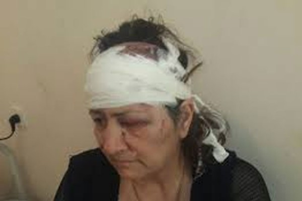 Sumqayıtda olay: Kürəkən qayınanasını döydü