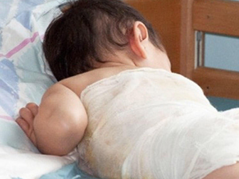 2 yaşlı uşaq xlor, 16 yaşlı qız kamfora yağı içdi