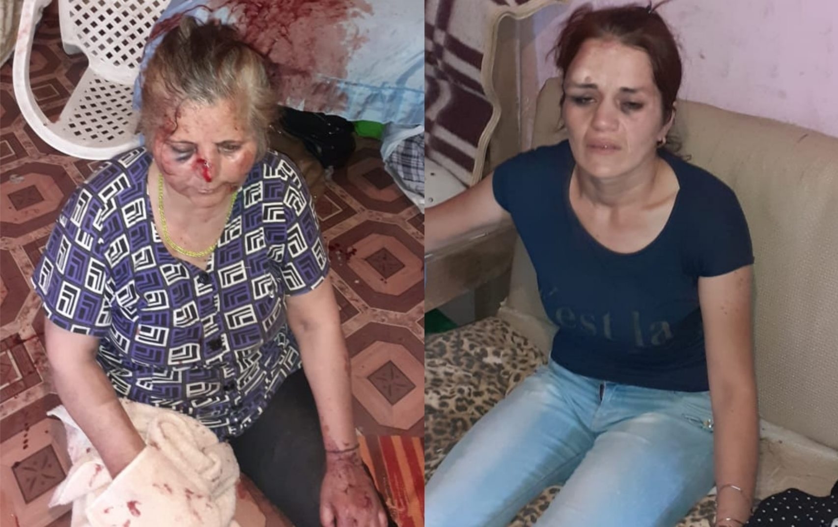 Bakıda qaynanasını döyən kürəkən saxlanılıb