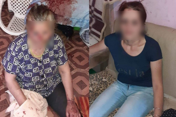Bakıda qayınanasını vəhşicəsinə döyən kürəkəndən xəbər var