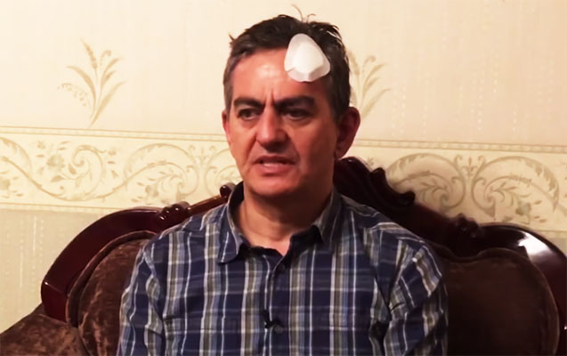 “Əli Kərimli polisləri yaralayıb, başını avtobusa özü vurub” - Baş prokurorluq