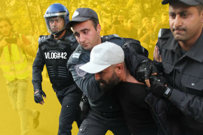 Ağrıyan qol və ağrıdan vicdansızlıq - VİDEOBLOQ