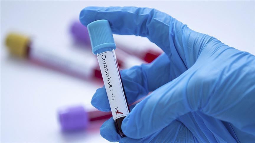Azərbaycanlı deputatların heç birində koronavirus aşkarlanmadı