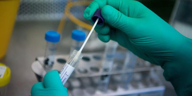 Koronavirus Türkiyəyə də çatdı: Nazir canlı yayımda açıqladı
