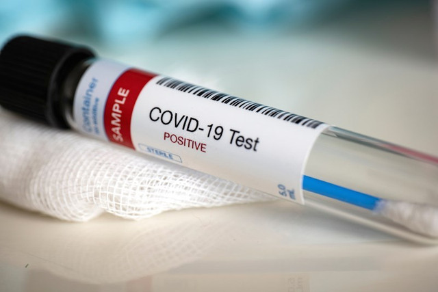 Azərbaycanda daha 27 nəfərdə koronavirus aşkarlandı - RƏSMİ