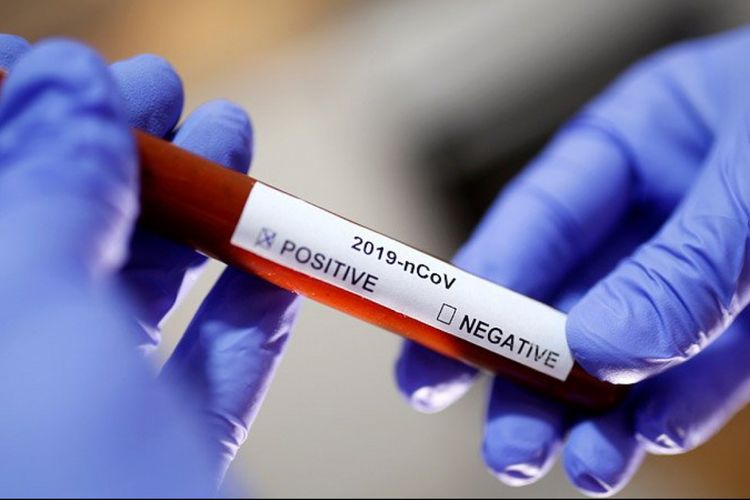 Rusiyada son sutkada 601 nəfərdə koronavirus aşkarlandı - dörd nəfər öldü