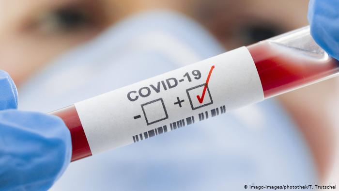 Azərbaycana bu günə qədər 44753 nəfər koronavirus testi verib