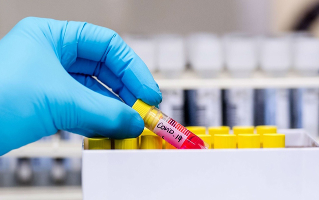 Azərbaycanda daha 65 nəfərdə koronavirus aşkarlandı, 1 nəfər vəfat etdi