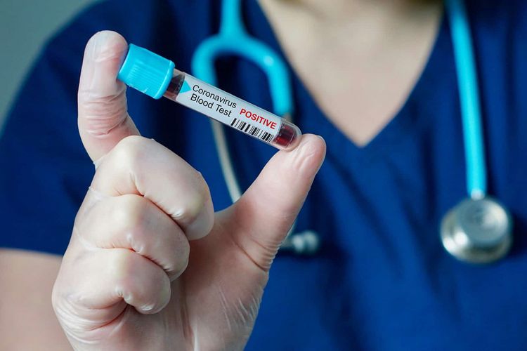 Ukraynada daha 444 nəfərdə koronavirus aşkarlandı