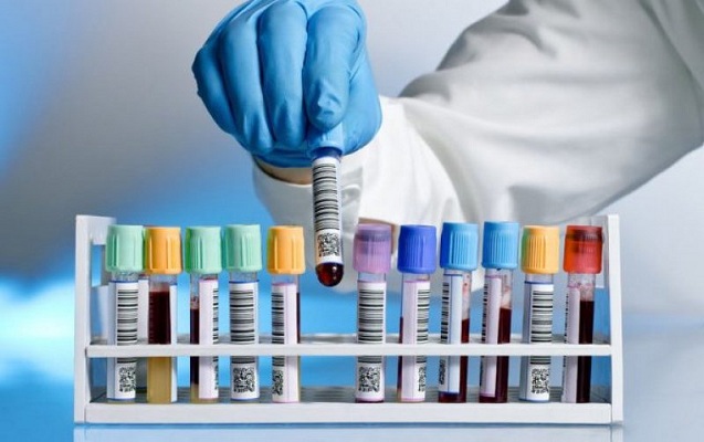 Azərbaycanda koronavirusla bağlı 95 mindən çox test aparılıb