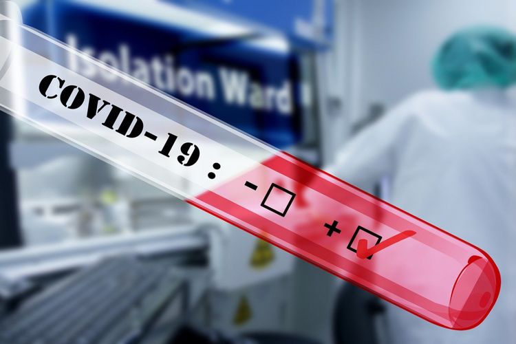 Rusiyada koronavirusdan ölənlərin sayı 400-ü keçib