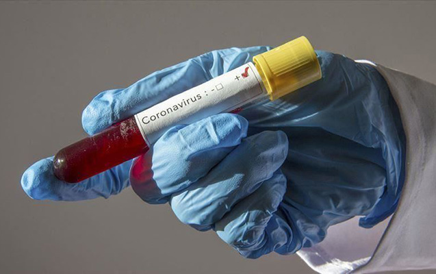 Azərbaycanda daha 33 nəfərdə koronavirus aşkarlandı - 1 nəfər vəfat etdi