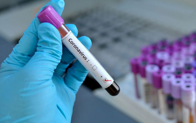 Azərbaycanda daha 38 nəfərdə koronavirus tapıldı - 30 nəfər sağaldı
