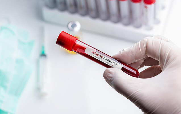 Azərbaycanda daha 52 nəfərdə koronavirus tapıldı - 1 nəfər vəfat etdi