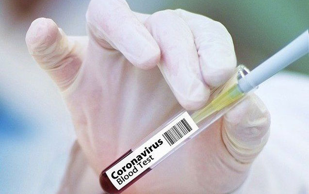 Azərbaycanda daha 67 nəfərdə koronavirus aşkarlandı - 2 nəfər vəfat etdi