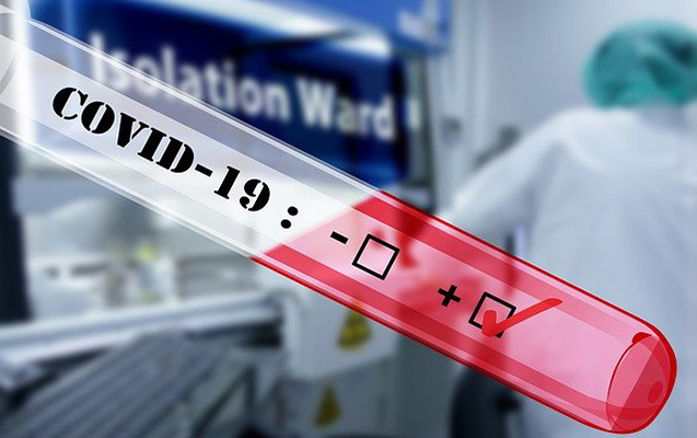 Azərbaycanda daha 75 nəfərdə koronavirus aşkarlandı