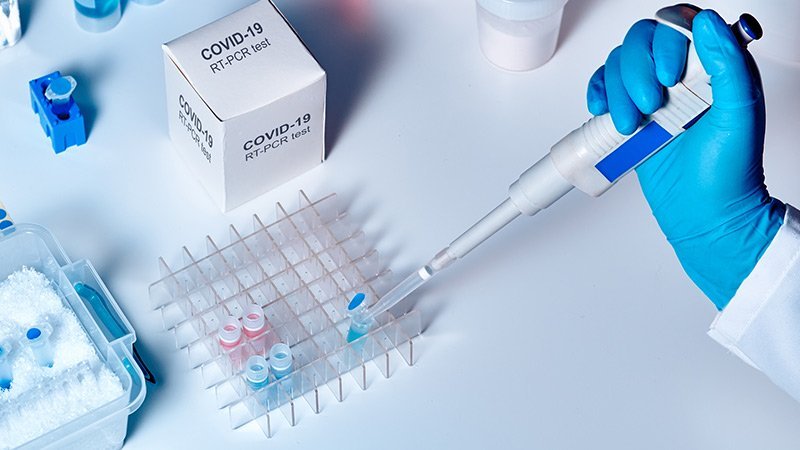 Azərbaycanda koronavirusla bağlı testlərin sayı açıqlandı - RƏSMİ