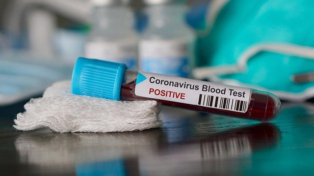 Azərbaycanda daha 104 nəfər koronavirusa yoluxdu, 1 nəfər öldü