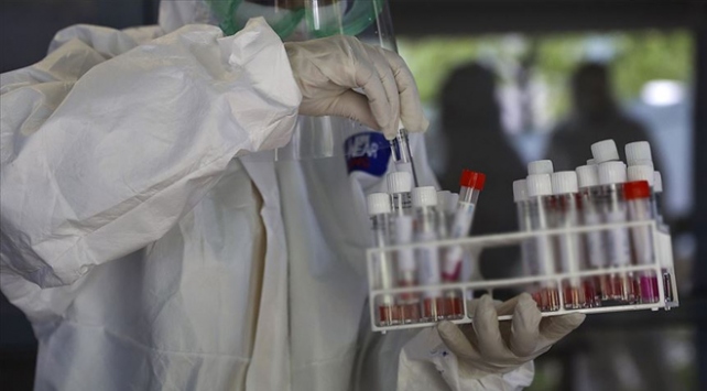 Azərbaycanda daha 121 nəfərdə koronavirus aşkarlandı
