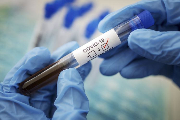 Naxçıvanda 106 nəfərdə koronavirus aşkarlandı