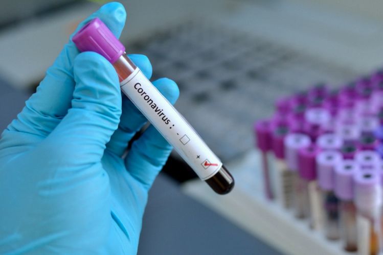 İranda son sutkada koronavirusdan 48 nəfər öldü