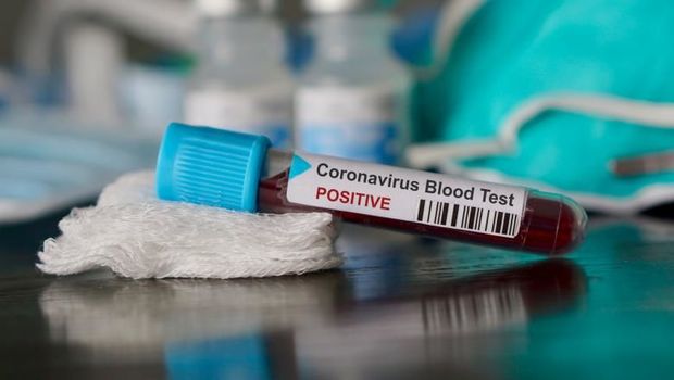 Bakıya gətirilən 29 azərbaycanlıda koronavirus aşkarlandı - RƏSMİ