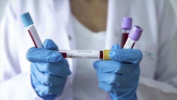 Dünyada koronavirusla bağlı son STATİSTİKA