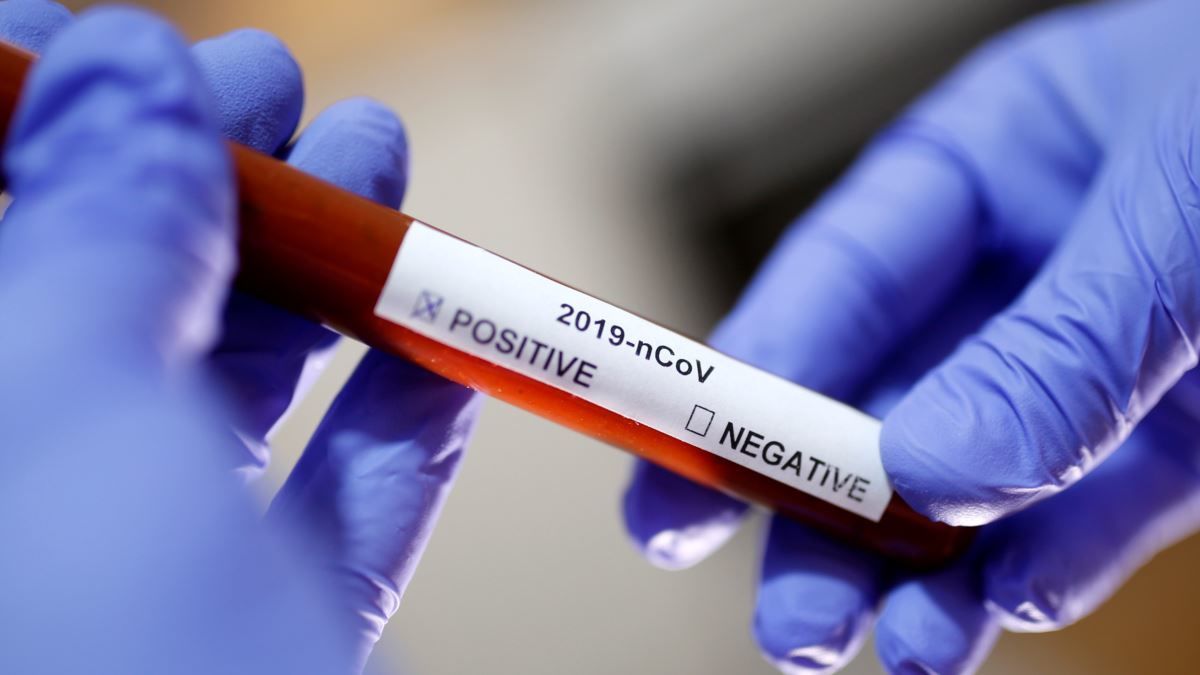 İranda koronavirus qurbanlarının sayı 7 minə çatdı