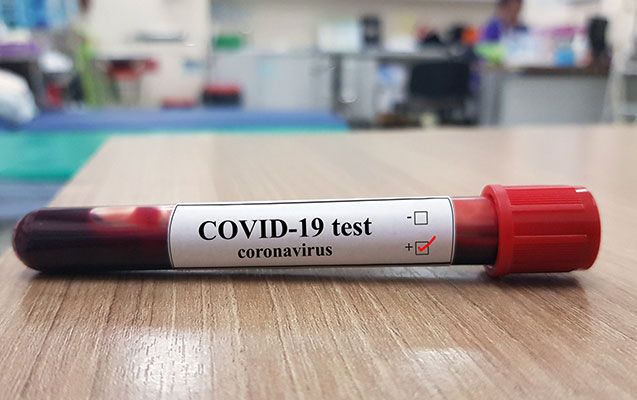 Azərbaycanda daha 118 nəfərdə koronavirus aşkarlandı - 1 nəfər vəfat etdi