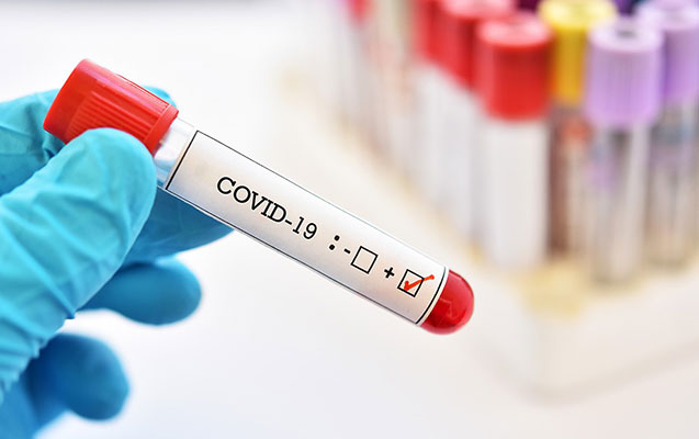 Azərbaycanda daha 127 nəfərdə koronavirus aşkarlandı - 3 nəfər vəfat etdi