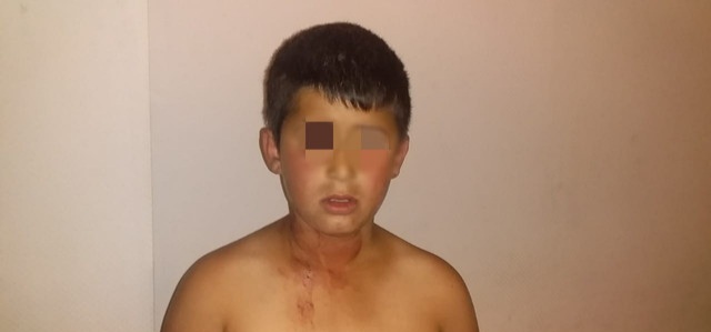 Bakı polisi: Azyaşlının dilənçiliyə cəlb edilməsi faktı təsdiqini tapmayıb