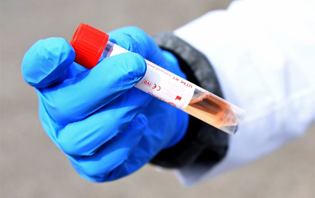Bu gün 248 nəfərdə koronavirus aşkarlandı - 2 nəfər öldü