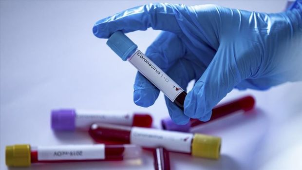 Jurnalistin ailəsində koronavirus aşkarlandı