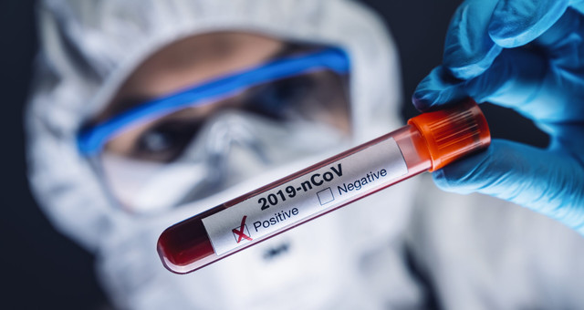 Daha 323 nəfərdə koronavirus aşkarlandı - 5 nəfər vəfat etdi