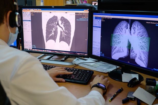 COVID-19-un müalicəsində effektli dərman tapıldı