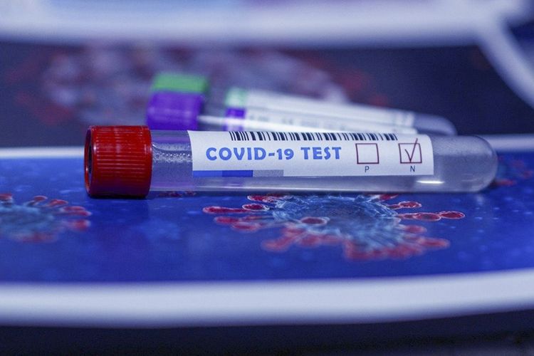 Rusiyada COVID-19-dan 489 tibb işçisi ölüb