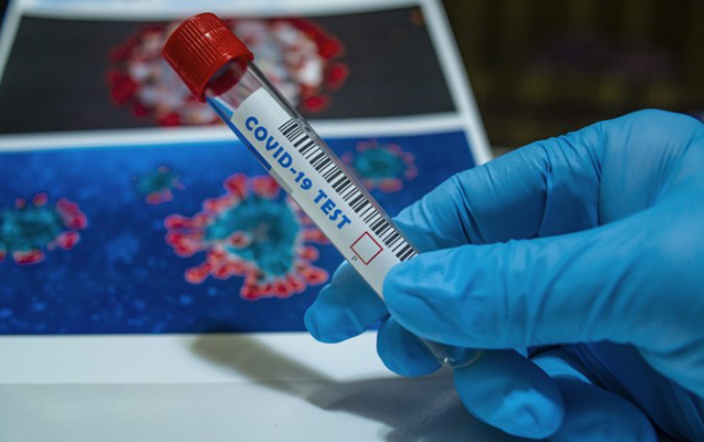 Azərbaycanda daha 478 nəfər koronavirusa yoluxdu, 7 nəfər öldü