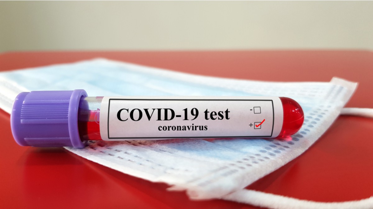 Azərbaycanlılar yaşayan daha bir kənddə koronavirus aşkarlanıb