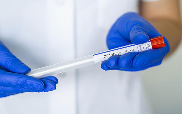 İlk dəfə 9 mindən çox test aparıldı