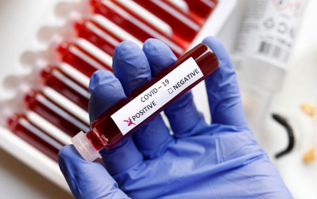 Azərbaycanda daha 556 nəfərdə koronavirus aşkarlandı - 7 nəfər öldü