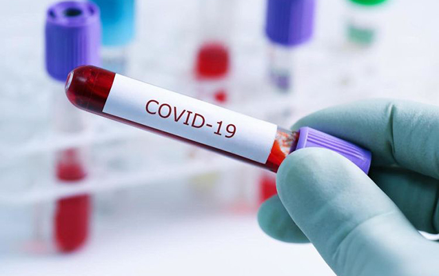 Azərbaycanda daha 523 nəfər koronavirusa yoluxdu, 9 nəfər öldü