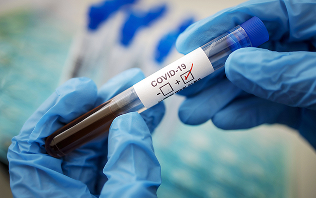 Azərbaycanda daha 542 nəfərdə koronavirus aşkarlandı, 9 nəfər öldü