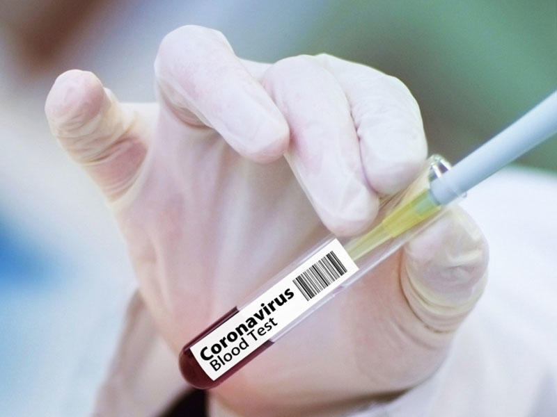 Rusiyada koronavirus vaksininin sınaqlarının son mərhələsi başladı