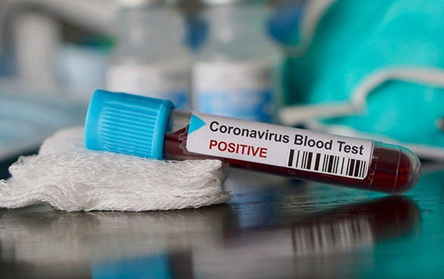 Azərbaycanda daha 449 nəfər sağaldı, 352 nəfərdə koronavirus aşkarlandı