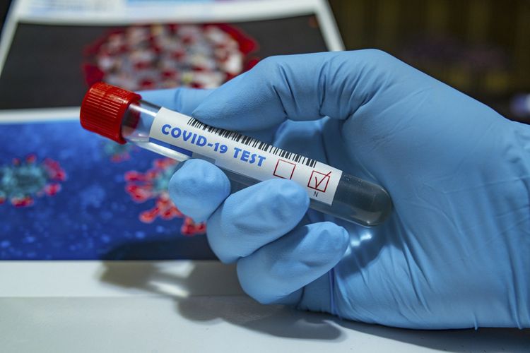 Azərbaycanda daha 91 nəfər koronavirusa yoluxdu, 211 nəfər sağaldı